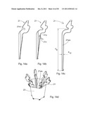 SURGICAL RETRACTOR diagram and image