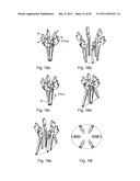 SURGICAL RETRACTOR diagram and image