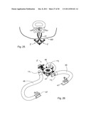 SURGICAL RETRACTOR diagram and image