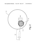 Tissue Marking for Lesion Removal diagram and image