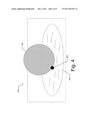 Tissue Marking for Lesion Removal diagram and image