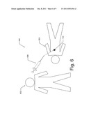 Tissue Marking for Lesion Removal diagram and image