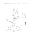 Tissue Marking for Lesion Removal diagram and image