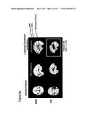 IMAGES OF LANGUAGE-SENSITIVE NEUROCIRCUITRY AS A DIAGNOSTIC FOR AUTISM diagram and image