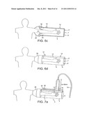 DEVICE FOR APPLYING A PULSATING PRESSURE TO A LOCAL REGION OF THE BODY AND     THE APPLICATIONS THEREOF diagram and image