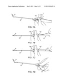 MEDICAL IMPLEMENT FOR MANIPULATING SUTURES PARTICULARLY USEFUL IN     ARTHROSCOPIC SURGERY diagram and image