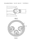 ATHERECTOMY DEVICES AND METHODS diagram and image