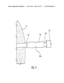 SELF-LOCKING CLOSURE DEVICE FOR PERCUTANEOUSLY SEALING PUNCTURES diagram and image