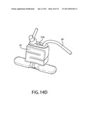 SELF-LOCKING CLOSURE DEVICE FOR PERCUTANEOUSLY SEALING PUNCTURES diagram and image