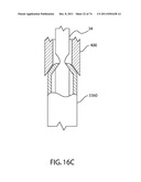 SELF-LOCKING CLOSURE DEVICE FOR PERCUTANEOUSLY SEALING PUNCTURES diagram and image