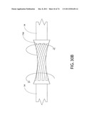 SELF-LOCKING CLOSURE DEVICE FOR PERCUTANEOUSLY SEALING PUNCTURES diagram and image