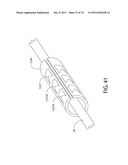 SELF-LOCKING CLOSURE DEVICE FOR PERCUTANEOUSLY SEALING PUNCTURES diagram and image