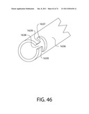 SELF-LOCKING CLOSURE DEVICE FOR PERCUTANEOUSLY SEALING PUNCTURES diagram and image