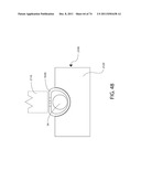 SELF-LOCKING CLOSURE DEVICE FOR PERCUTANEOUSLY SEALING PUNCTURES diagram and image