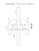 SELF-LOCKING CLOSURE DEVICE FOR PERCUTANEOUSLY SEALING PUNCTURES diagram and image