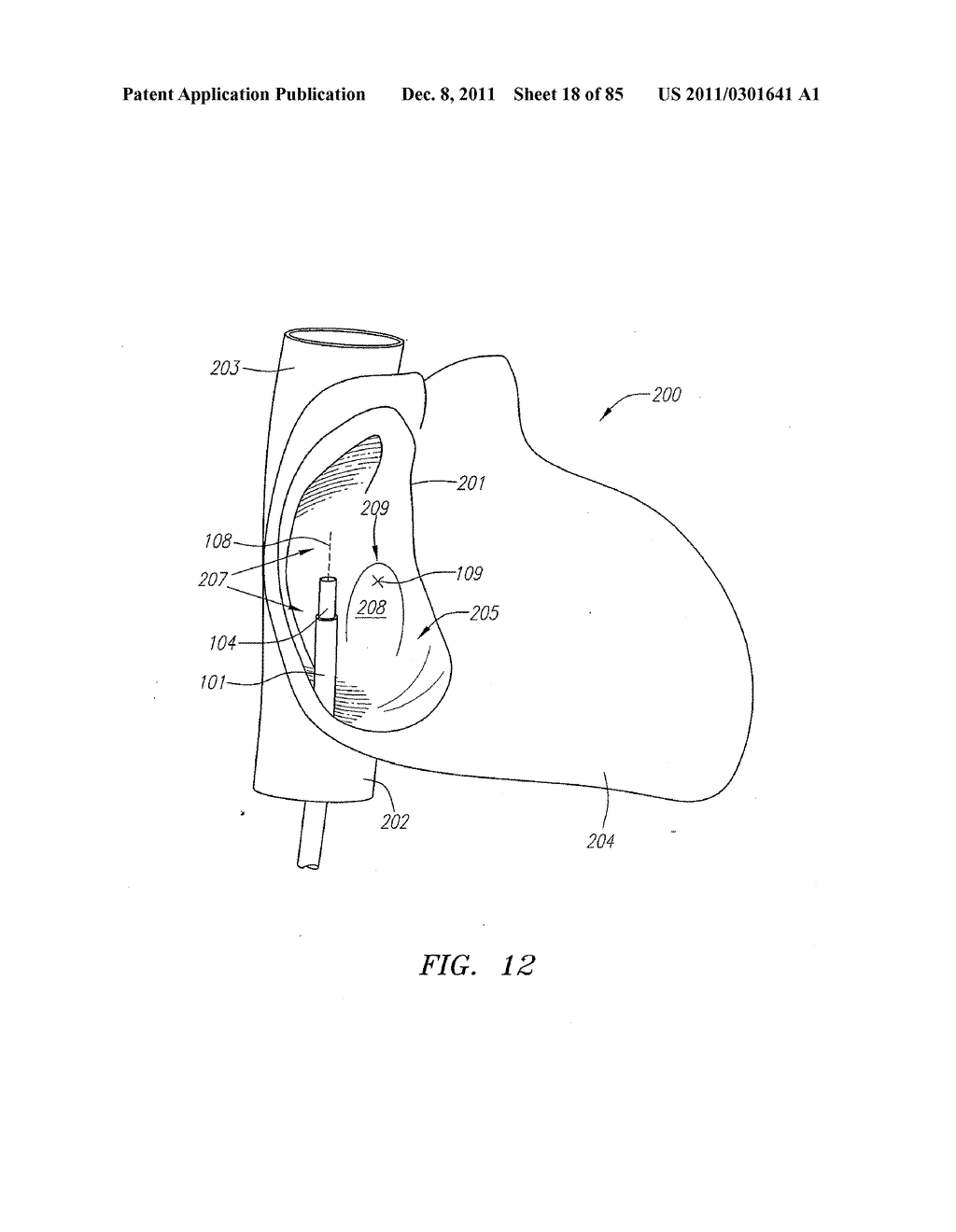 Systems And Methods For Treating Septal Defects - diagram, schematic, and image 19