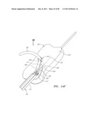 Systems And Methods For Treating Septal Defects diagram and image