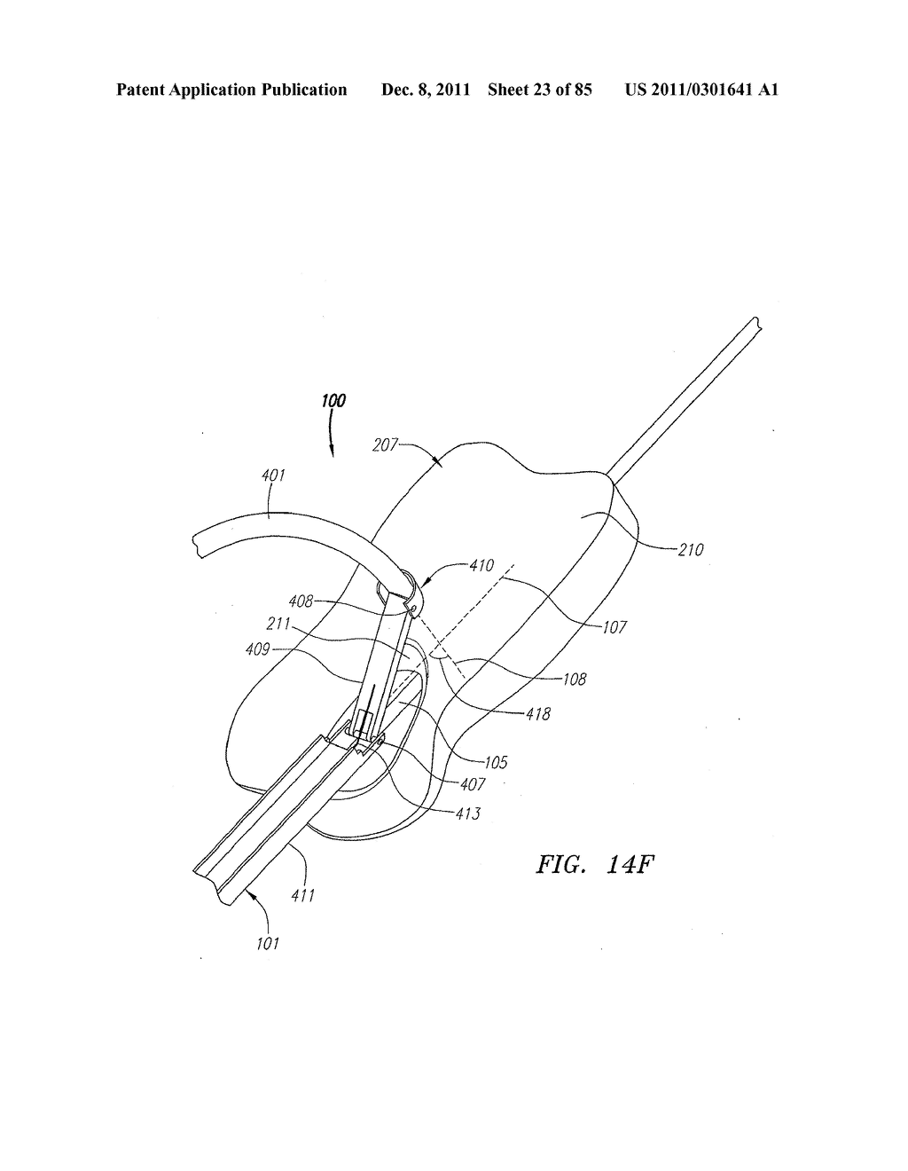 Systems And Methods For Treating Septal Defects - diagram, schematic, and image 24