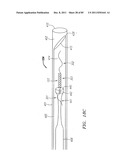 Systems And Methods For Treating Septal Defects diagram and image