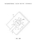 Systems And Methods For Treating Septal Defects diagram and image