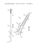 Hammer toe implant with expansion portion for retrograde approach diagram and image