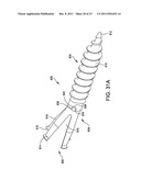 Hammer toe implant with expansion portion for retrograde approach diagram and image