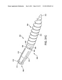 Hammer toe implant with expansion portion for retrograde approach diagram and image