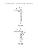 APPARATUS AND METHODS FOR TREATING TISSUE diagram and image