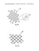 APPARATUS AND METHODS FOR TREATING TISSUE diagram and image