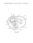 APPARATUS AND METHODS FOR TREATING TISSUE diagram and image