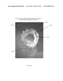 PERCUTANEOUSLY DELIVERABLE HEART VALVE AND METHODS ASSOCIATED THEREWITH diagram and image