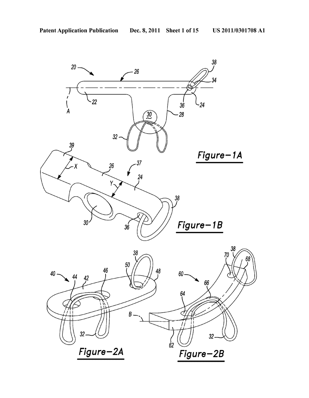 Method and Apparatus for Soft Tissue Fixation - diagram, schematic, and image 02