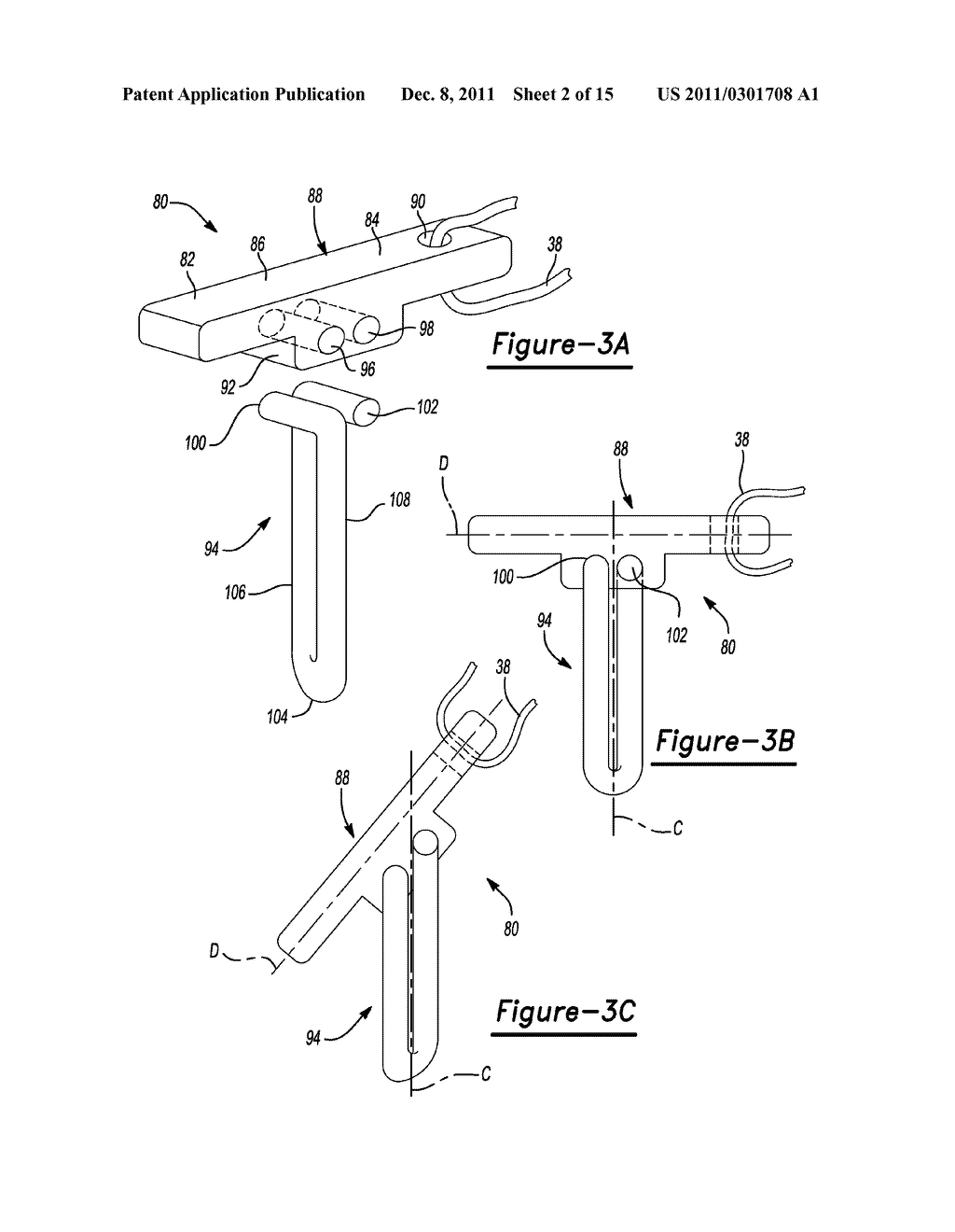 Method and Apparatus for Soft Tissue Fixation - diagram, schematic, and image 03