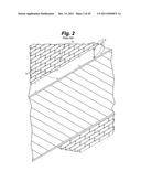 TRELLIS AND ACCENT BAND diagram and image