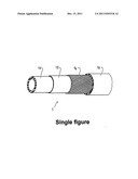 Pipe for the Air Intake Circuit of a Motor Vehicle Engine, and Circuit     Incorporating the Same diagram and image