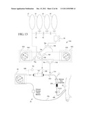 HEMODIALYSIS SYSTEM WITH HORIZONTAL CASSETTE ROLLER PUMPS diagram and image