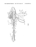 Powered Surgical Stapling Device diagram and image