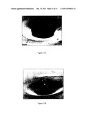  METHOD OF GENERATING A HOLE OR RECESS OR WELL IN A SUBSTRATE diagram and image