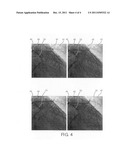 MEDICAL VIEWING SYSTEM FOR DISPLAYING A REGION OF INTEREST ON MEDICAL     IMAGES diagram and image