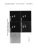 Anti-lipid antibodies diagram and image