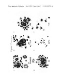 Anti-lipid antibodies diagram and image