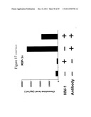 Anti-lipid antibodies diagram and image