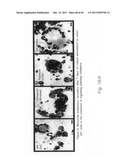 Anti-lipid antibodies diagram and image