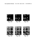 POLYMERSOMES, COLLOIDOSOMES, LIPOSOMES, AND OTHER SPECIES ASSOCIATED WITH     FLUIDIC DROPLETS diagram and image