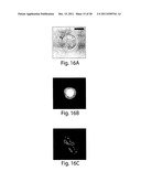 POLYMERSOMES, COLLOIDOSOMES, LIPOSOMES, AND OTHER SPECIES ASSOCIATED WITH     FLUIDIC DROPLETS diagram and image