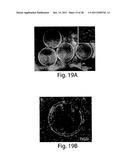 POLYMERSOMES, COLLOIDOSOMES, LIPOSOMES, AND OTHER SPECIES ASSOCIATED WITH     FLUIDIC DROPLETS diagram and image