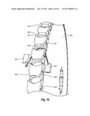 MOON GEAR ASSEMBLY diagram and image