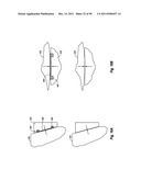 MOON GEAR ASSEMBLY diagram and image