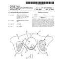 METHOD OF TREATING INCONTINENCE diagram and image