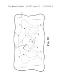 METHOD OF TREATING INCONTINENCE diagram and image